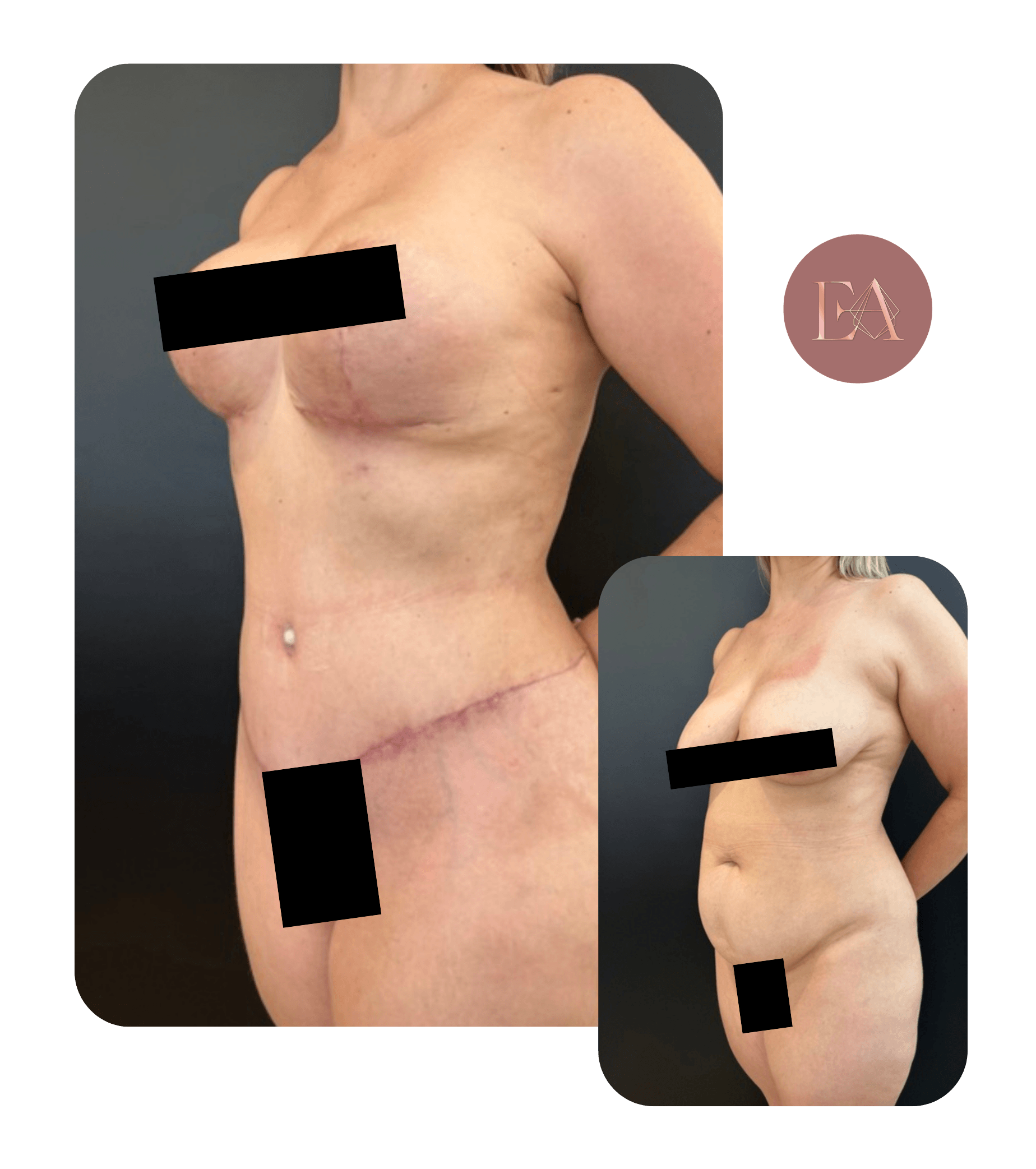 Antes e depois de paciente da Dra. Emelyn