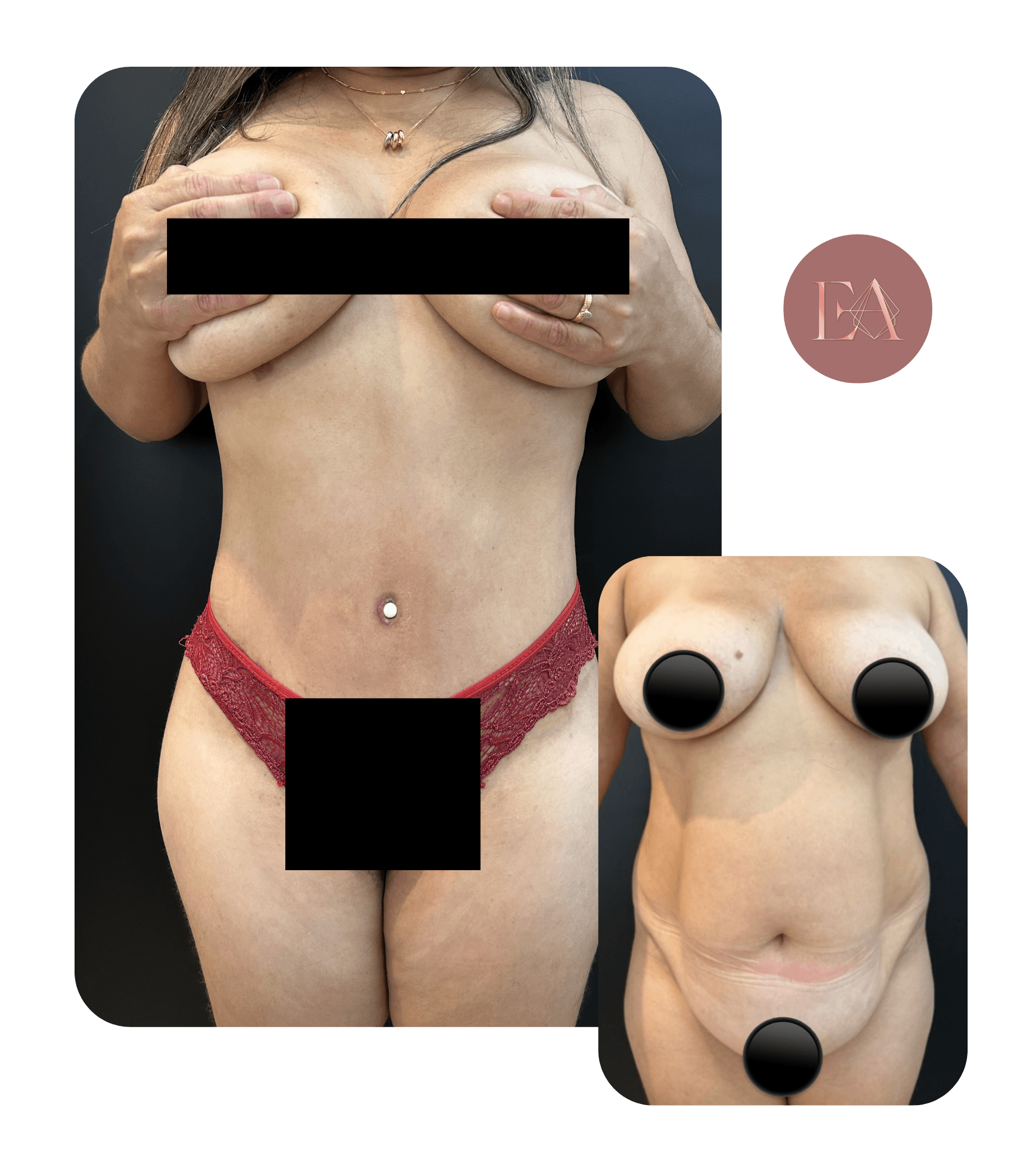 Antes e depois de paciente da Dra. Emelyn